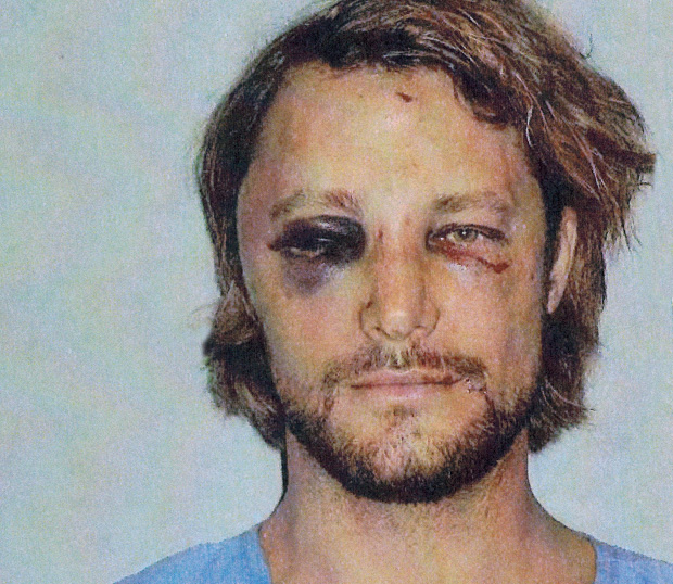 Gabriel Aubry Assaulted